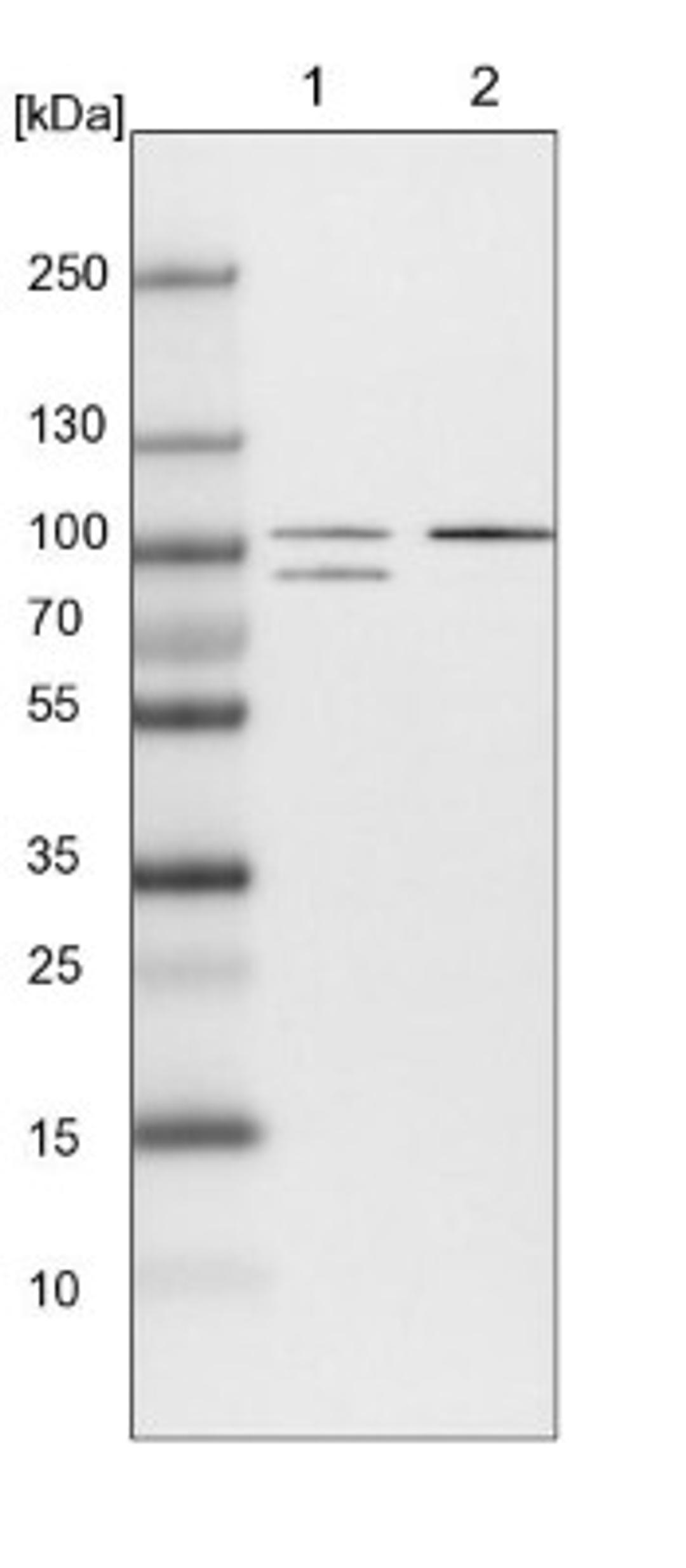 Western Blot: DLGAP2 Antibody [NBP1-90602] - Lane 1: NIH-3T3 cell lysate (Mouse embryonic fibroblast cells)<br/>Lane 2: NBT-II cell lysate (Rat Wistar bladder tumour cells)