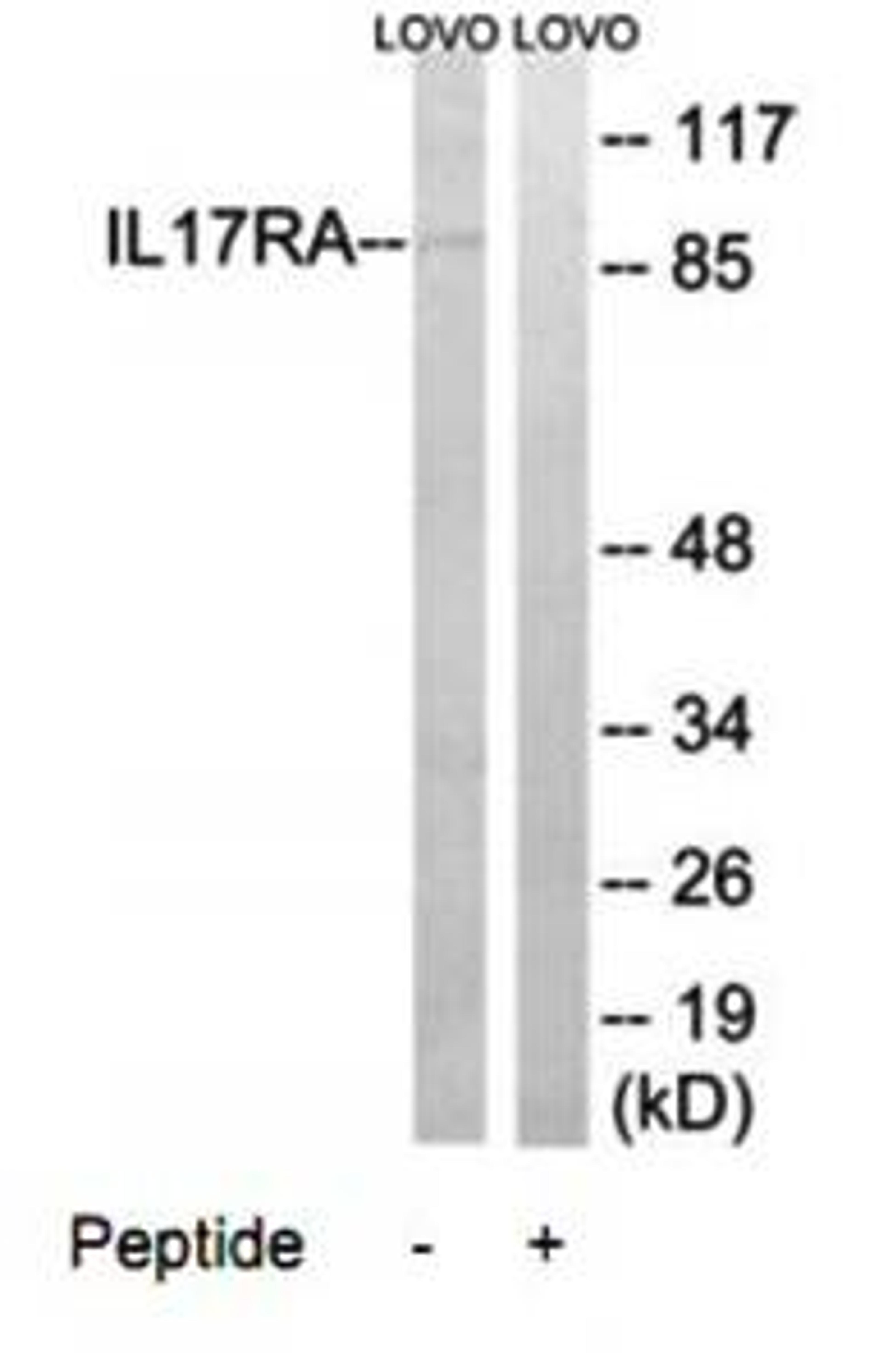 Western blot analysis of extracts from LOVO cells using IL17RA antibody