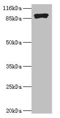 Western blot. All lanes: RRM1 antibody at 2µg/ml + Hela whole cell lysate. Secondary. Goat polyclonal to rabbit IgG at 1/10000 dilution. Predicted band size: 91 kDa. Observed band size: 91 kDa