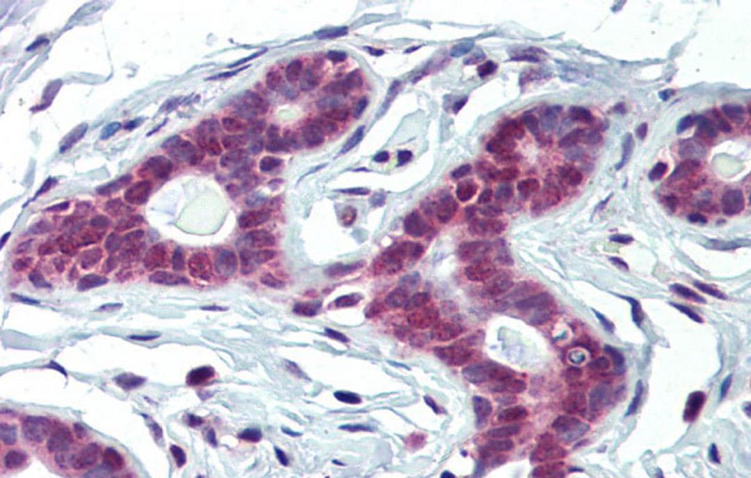 Antibody used in IHC on Human Breast at 5.0 ug/ml.