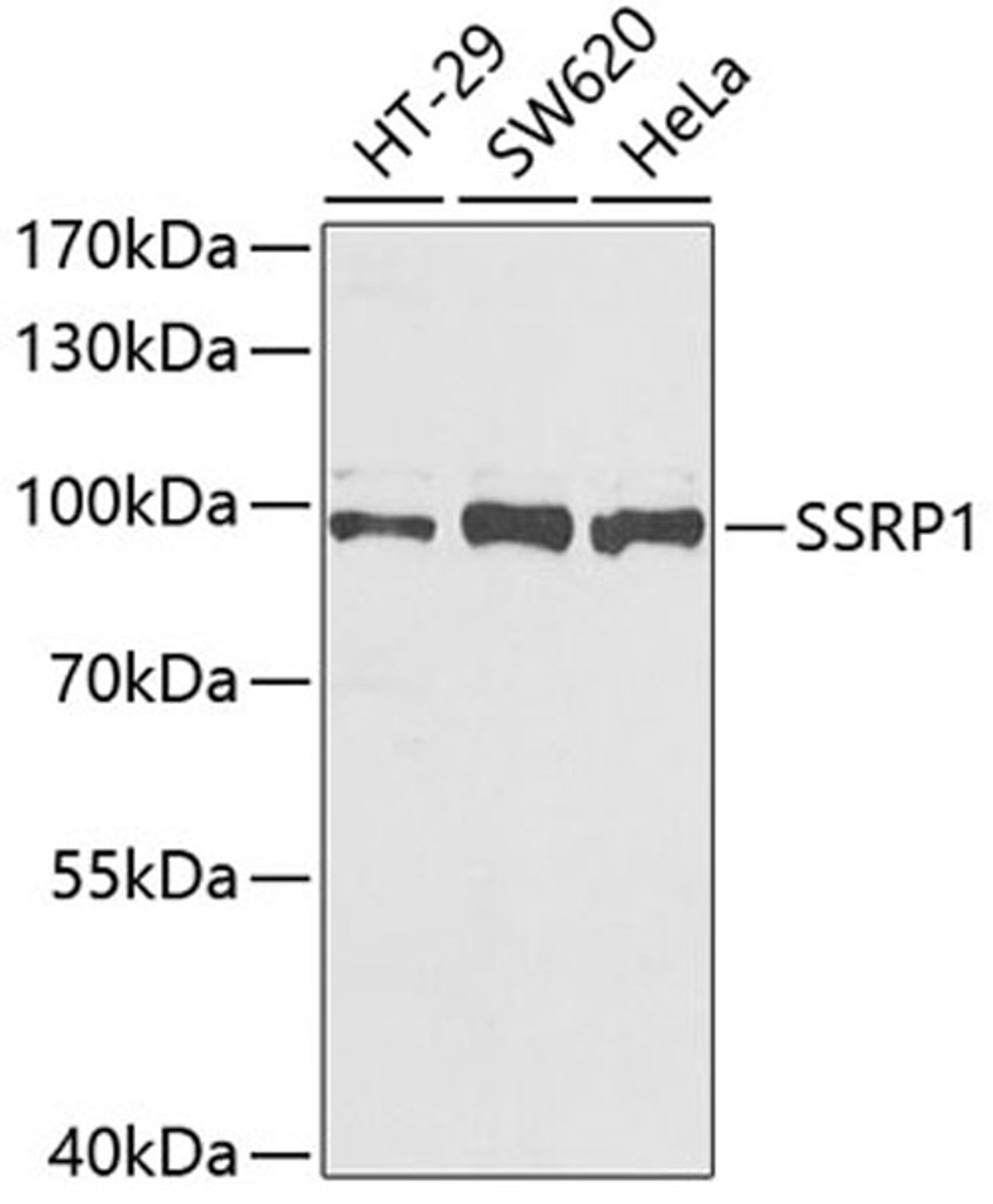 Western blot - SSRP1 antibody (A6413)