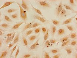 Immunocytochemistry analysis of Hela cells using CSB-PA010418PA27me1HU at dilution of 1:100