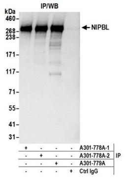 Detection of human NIPBL by western blot of immunoprecipitates.