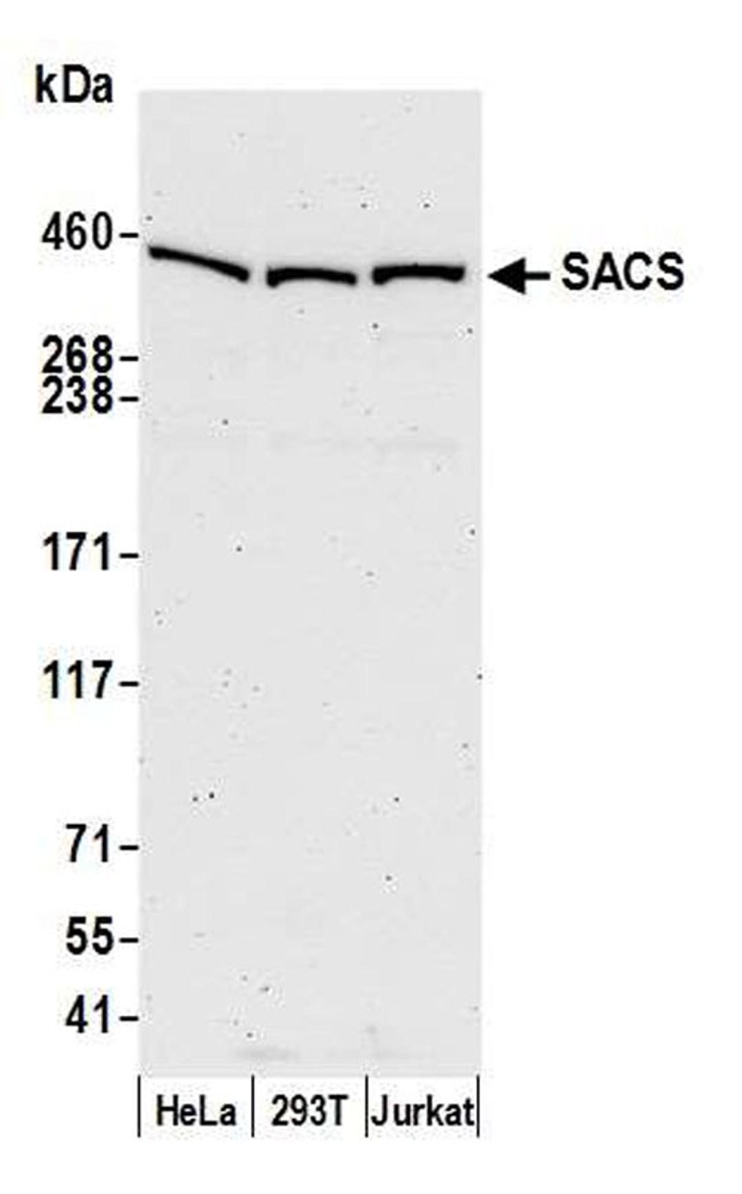 Detection of human SACS by WB.