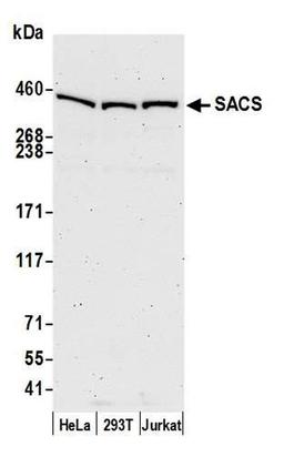 Detection of human SACS by WB.