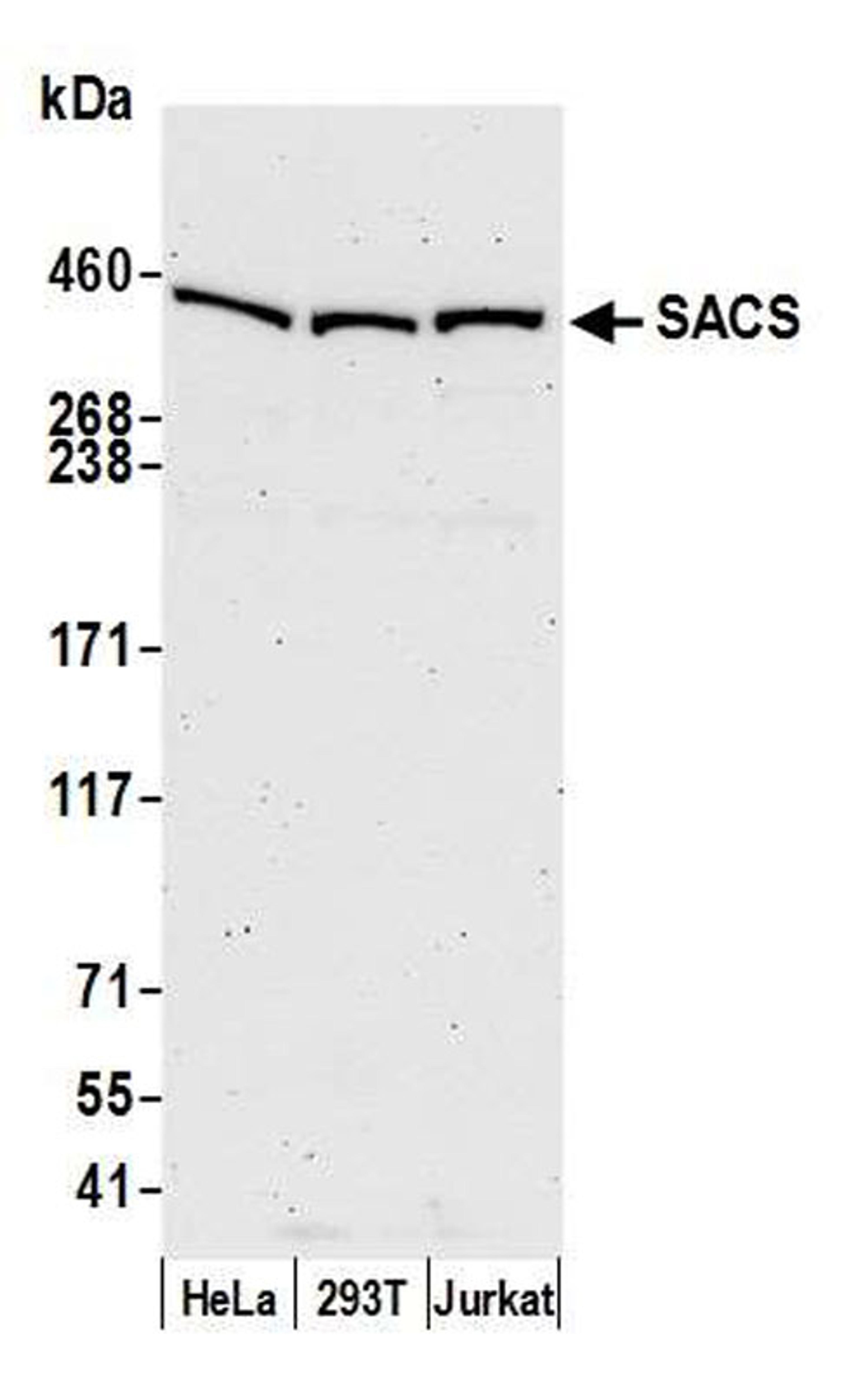 Detection of human SACS by WB.