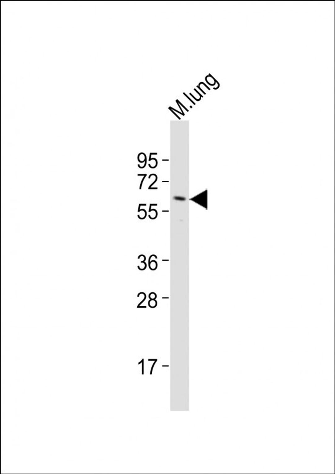 Western Blot at 1:2000 dilution + mouse lung lysates Lysates/proteins at 20 ug per lane.