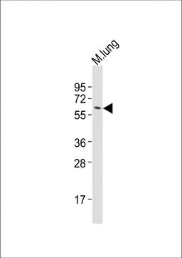 Western Blot at 1:2000 dilution + mouse lung lysates Lysates/proteins at 20 ug per lane.