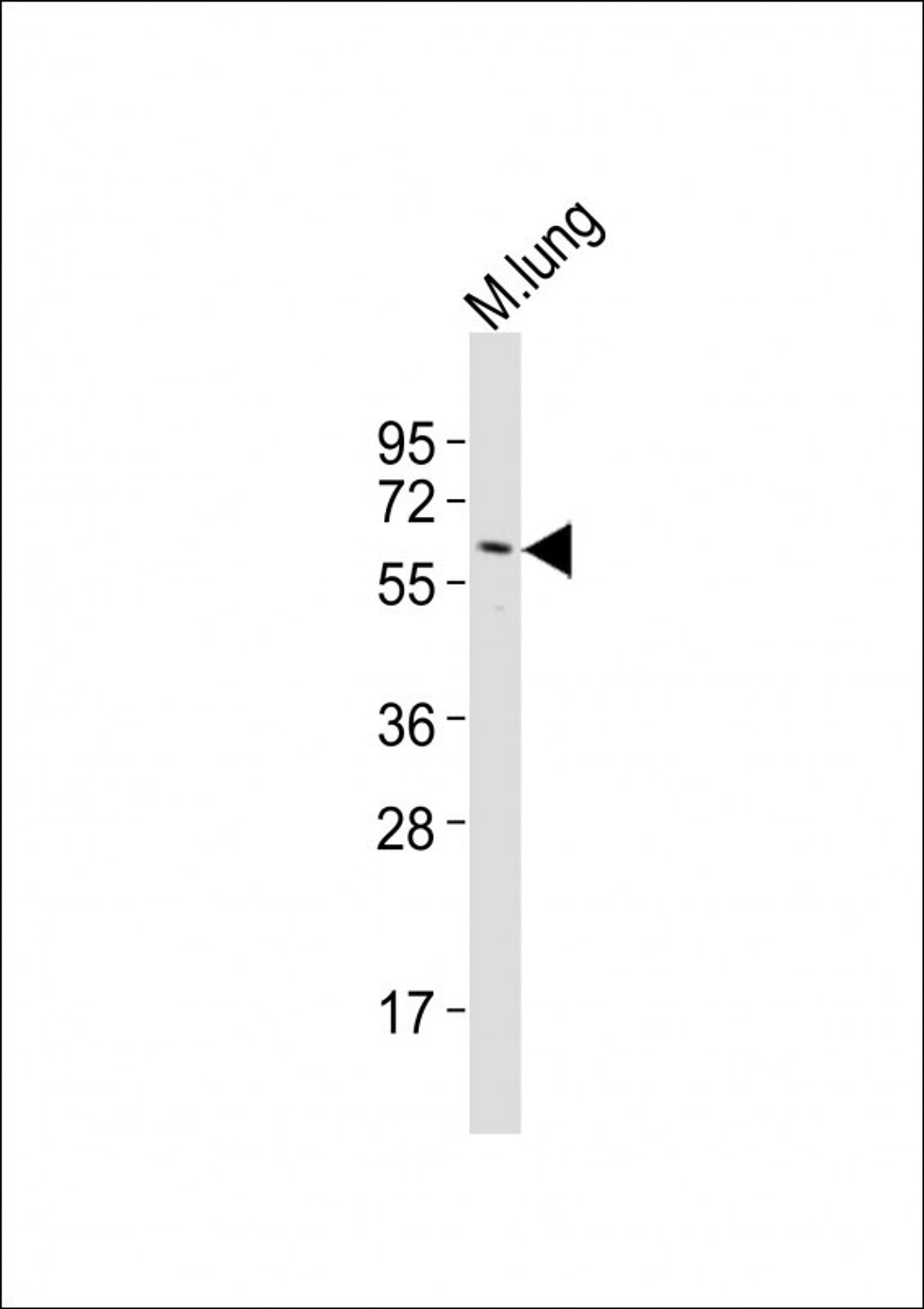 Western Blot at 1:2000 dilution + mouse lung lysates Lysates/proteins at 20 ug per lane.