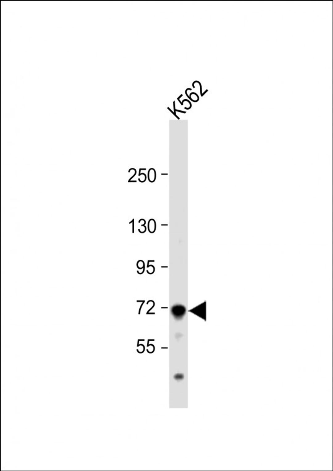 Western Blot at 1:1000 dilution + K562 whole cell lysate Lysates/proteins at 20 ug per lane.