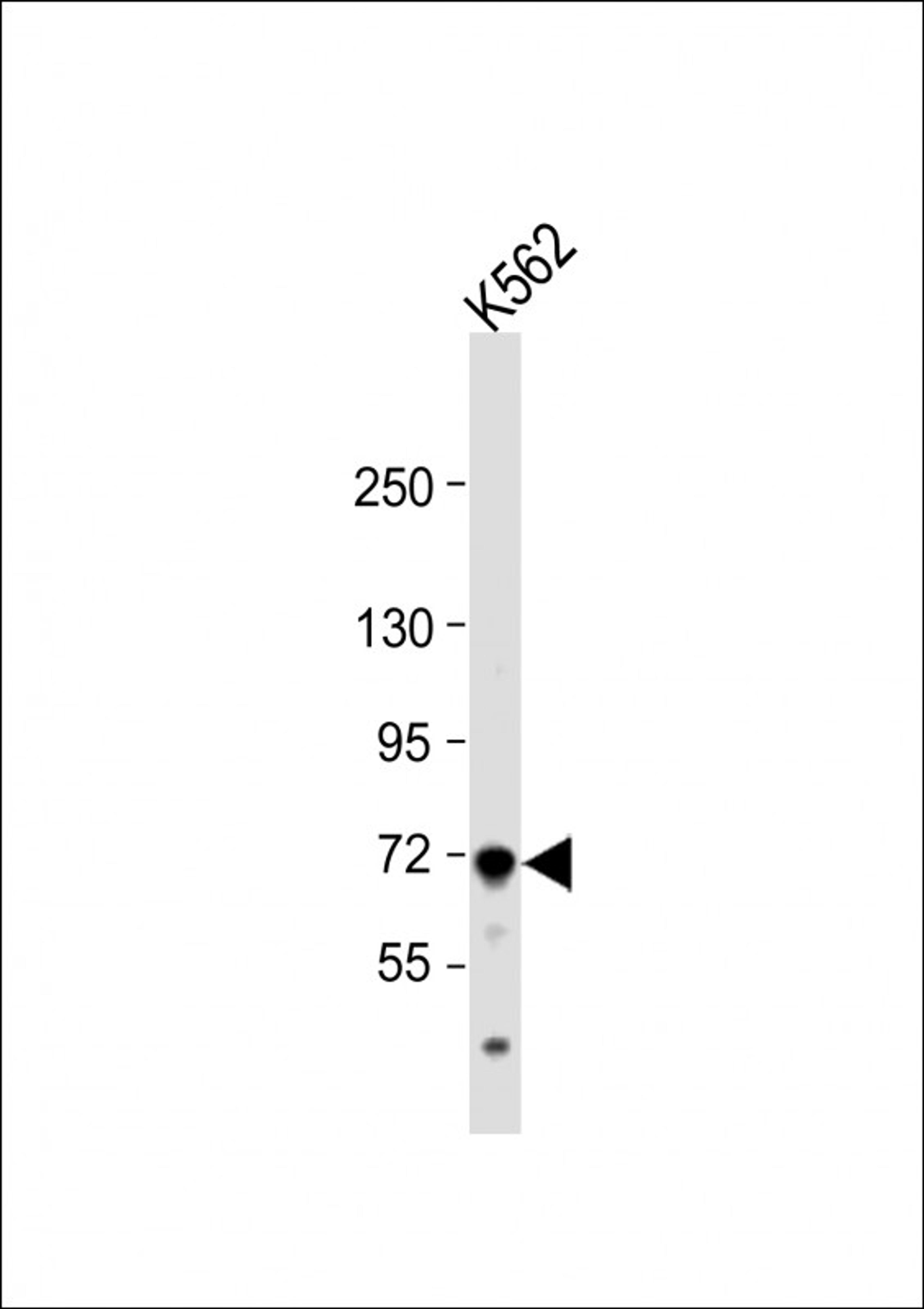 Western Blot at 1:1000 dilution + K562 whole cell lysate Lysates/proteins at 20 ug per lane.