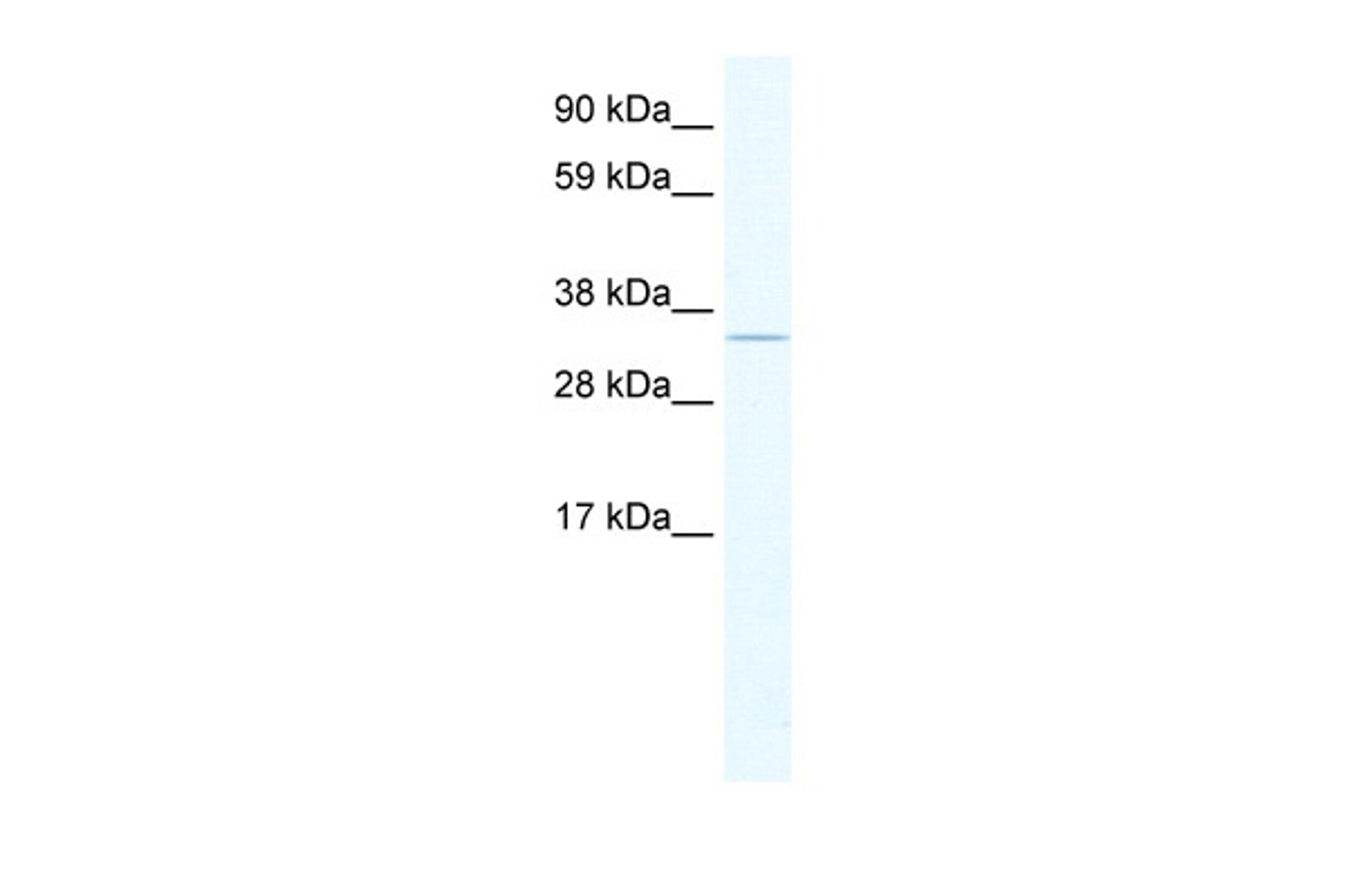 Antibody used in WB on Human Brain at 0.2-1 ug/ml.