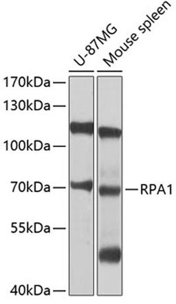 Western blot - RPA1 antibody (A0990)