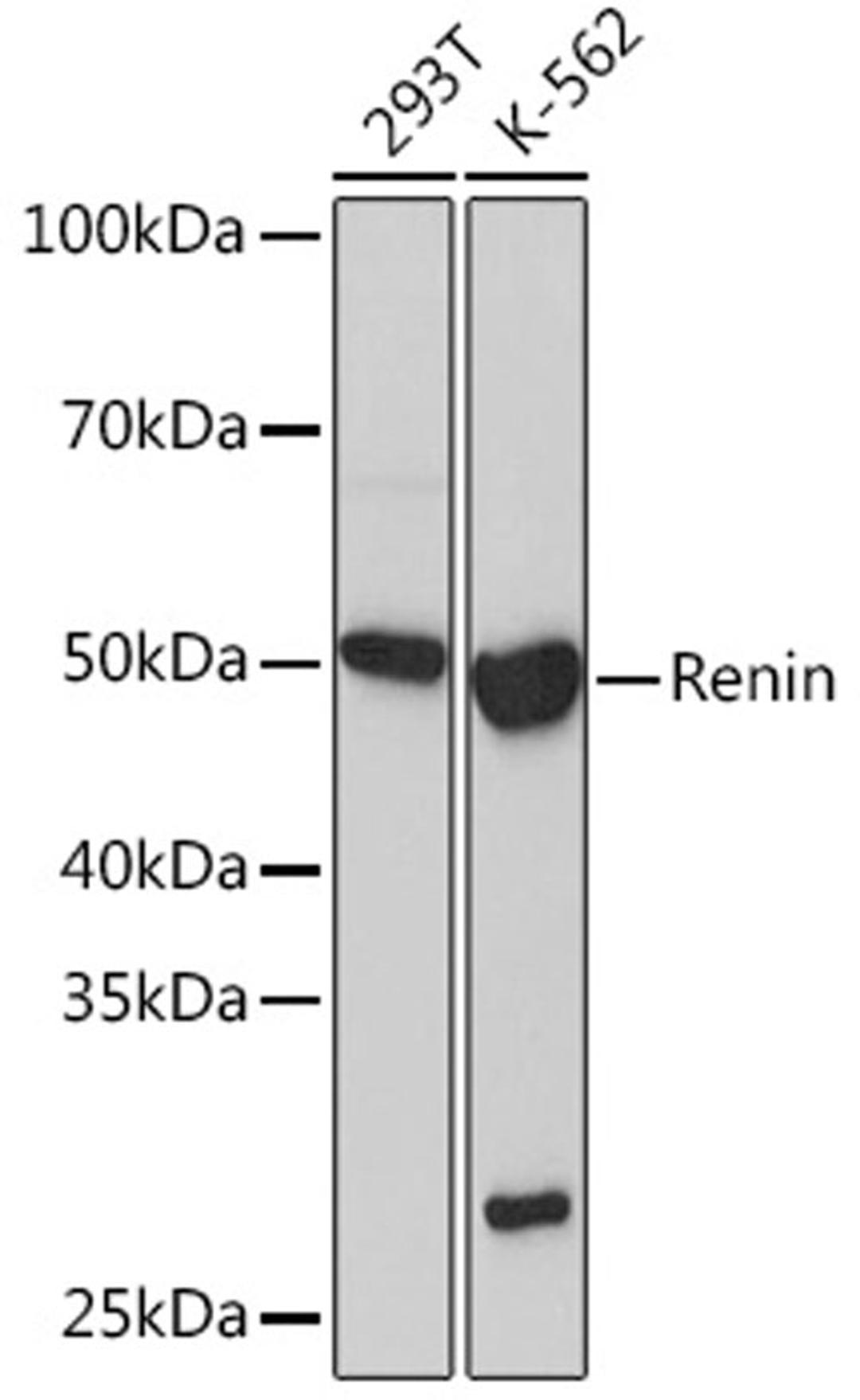 Western blot - Renin Rabbit mAb (A5197)