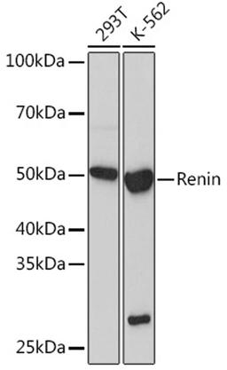 Western blot - Renin Rabbit mAb (A5197)