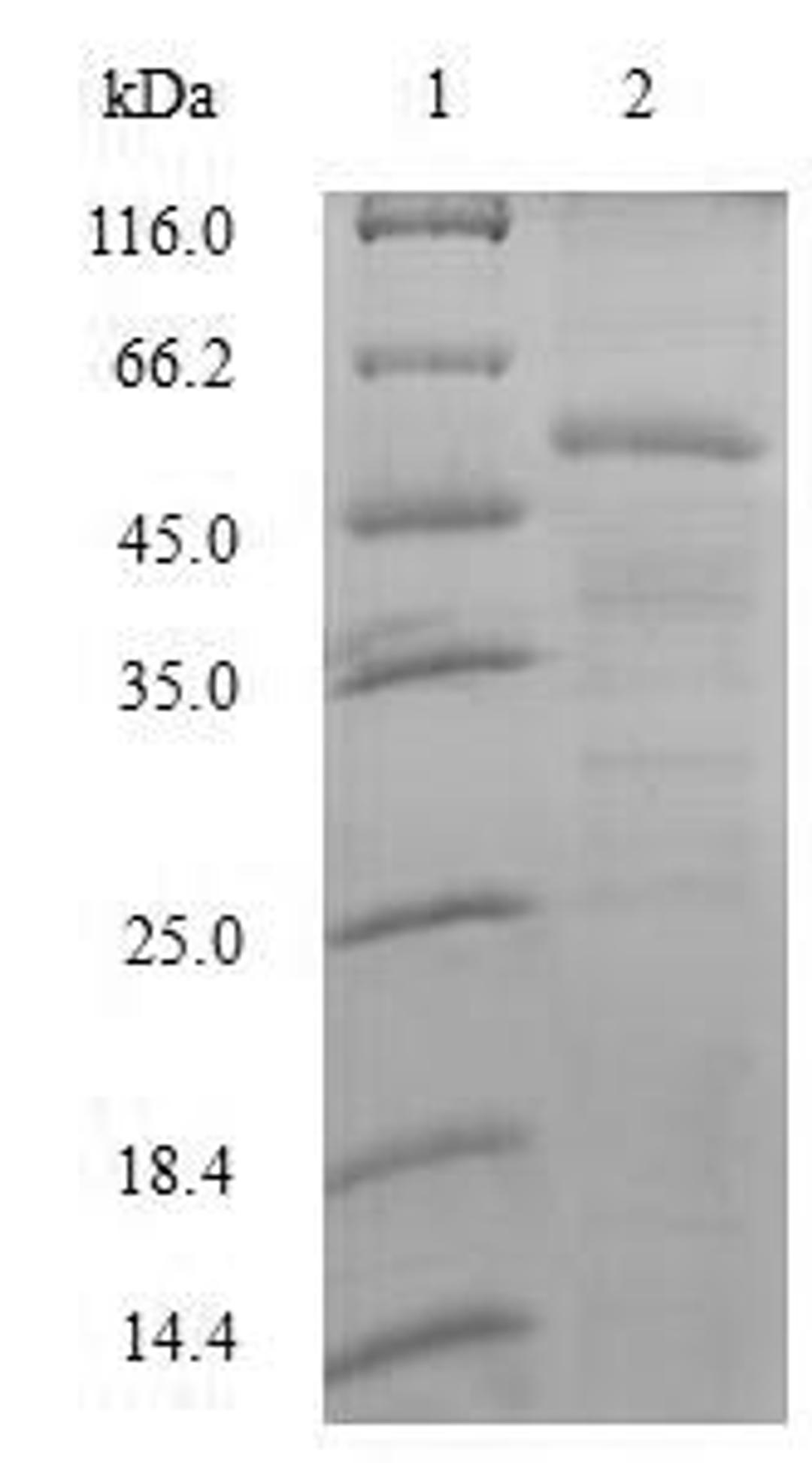 (Tris-Glycine gel) Discontinuous SDS-PAGE (reduced) with 5% enrichment gel and 15% separation gel.