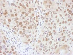 Detection of human RNF20 by immunohistochemistry.