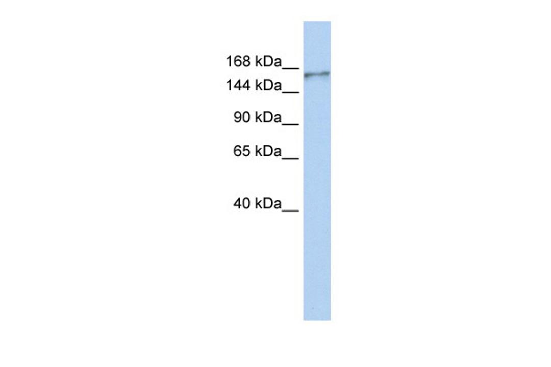 Antibody used in WB on Human MCF-7 at 0.2-1 ug/ml.