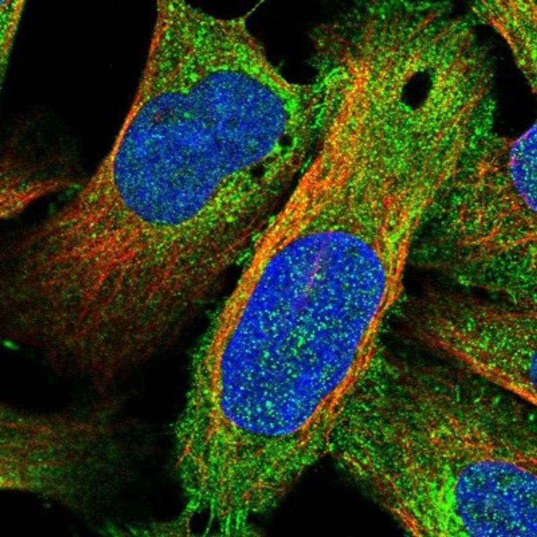 Immunocytochemistry/Immunofluorescence: SHCBP1L Antibody [NBP1-90716] - Staining of human cell line U-2 OS shows positivity in plasma membrane, cytoplasm & cell junctions.