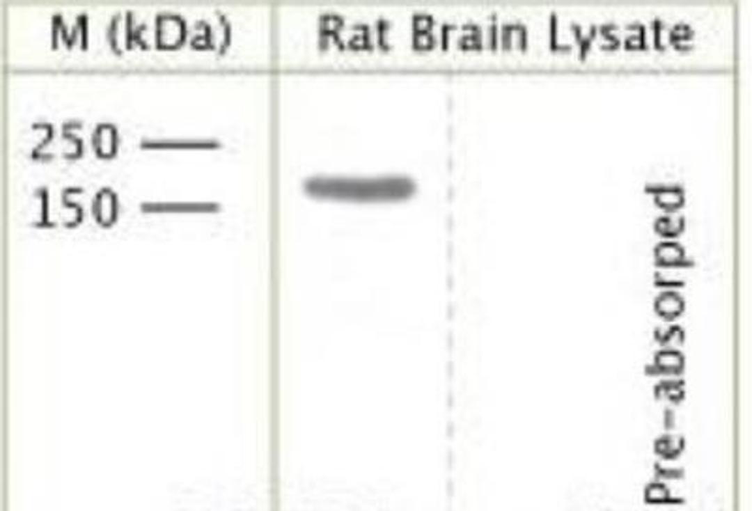 Western Blot: TrkC [p Tyr820] Antibody [NBP1-03448] - Rat brain lysate using Rabbit antibody to phospho Y820 TrkC: whole serum at 1:1000 dilution incubated overnight at 4 degrees C. A single band will be detected. Pre-absorption of the antibody with the immunising peptide completely abolishes the detected band.