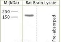 Western Blot: TrkC [p Tyr820] Antibody [NBP1-03448] - Rat brain lysate using Rabbit antibody to phospho Y820 TrkC: whole serum at 1:1000 dilution incubated overnight at 4 degrees C. A single band will be detected. Pre-absorption of the antibody with the immunising peptide completely abolishes the detected band.