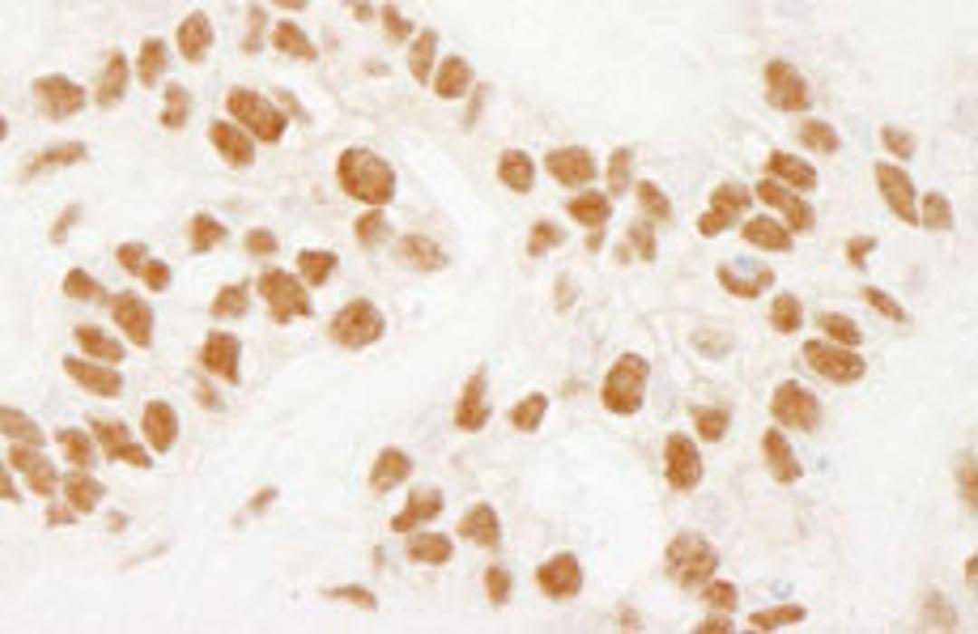 Detection of human NELFE by immunohistochemistry.