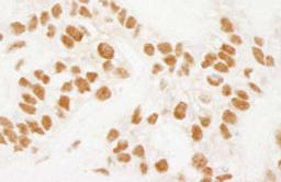 Detection of human NELFE by immunohistochemistry.