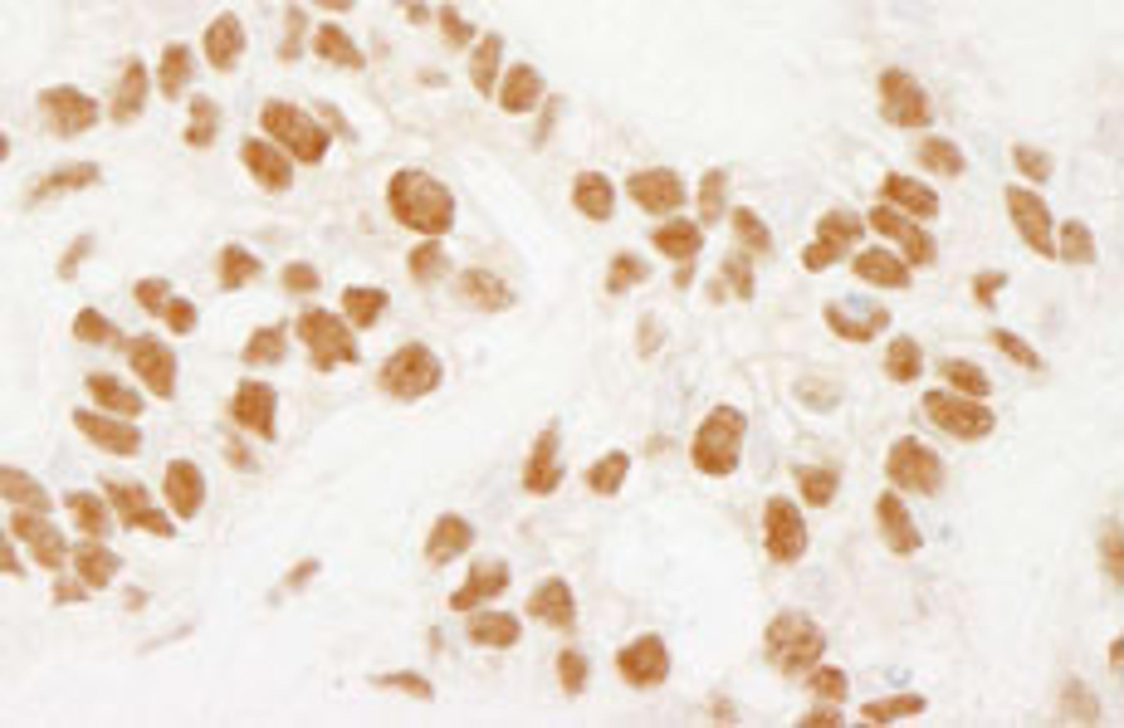 Detection of human NELFE by immunohistochemistry.