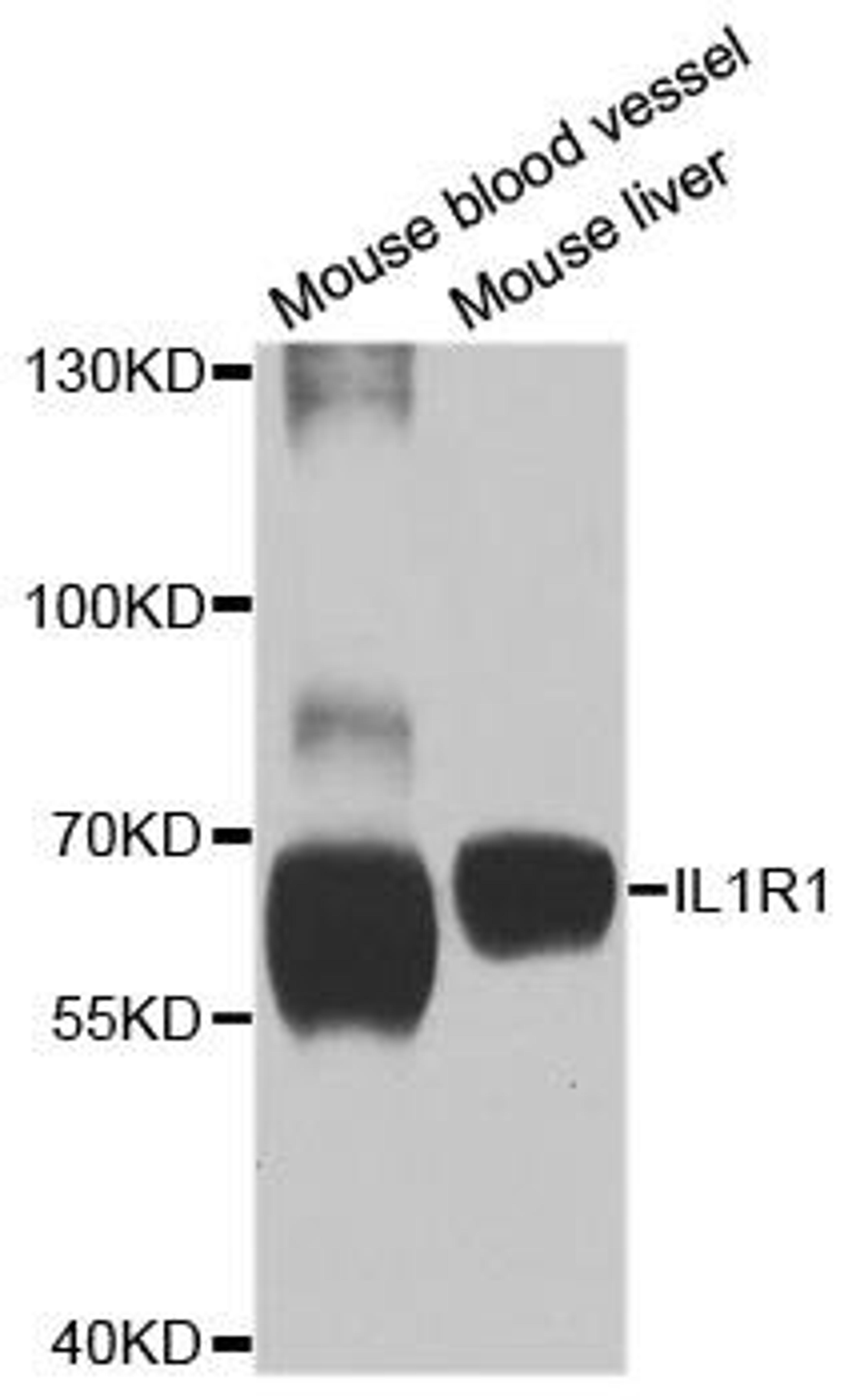 Western blot analysis of extracts of various cell lines using IL1R1 antibody