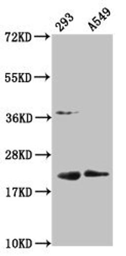 Western Blot. Positive WB detected in: 293 whole cell lysate, A549 whole cell lysate. All lanes: HIST1H1C antibody at 1:100. Secondary. Goat polyclonal to rabbit IgG at 1/50000 dilution. Predicted band size: 22 kDa. Observed band size: 22 kDa
