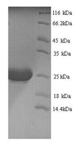 (Tris-Glycine gel) Discontinuous SDS-PAGE (reduced) with 5% enrichment gel and 15% separation gel.