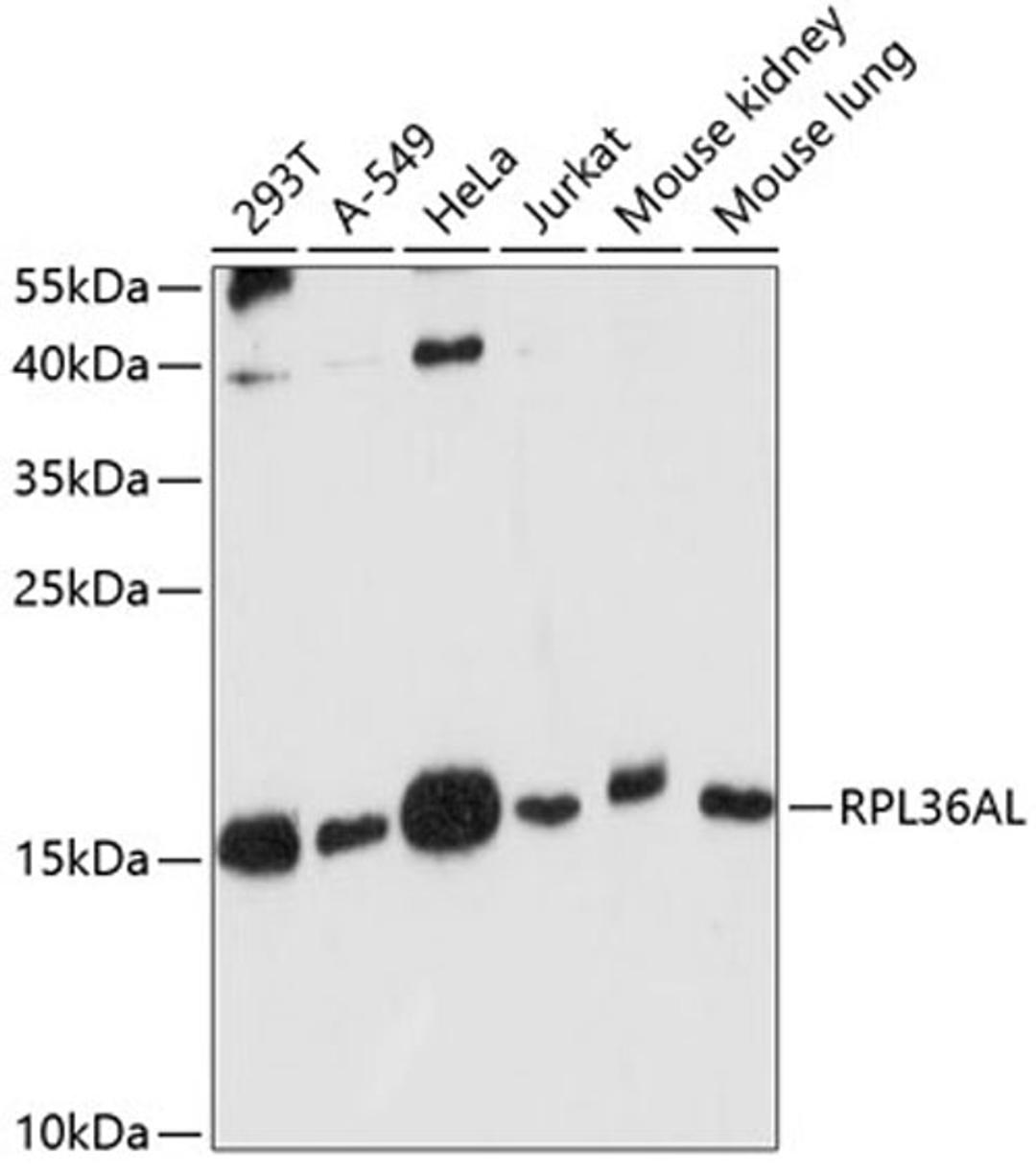 Western blot - RPL36AL antibody (A14366)