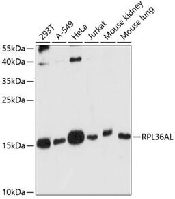 Western blot - RPL36AL antibody (A14366)