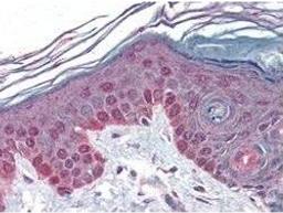 Immunohistochemical staining of human skin tissue using Cyclin T1 antibody