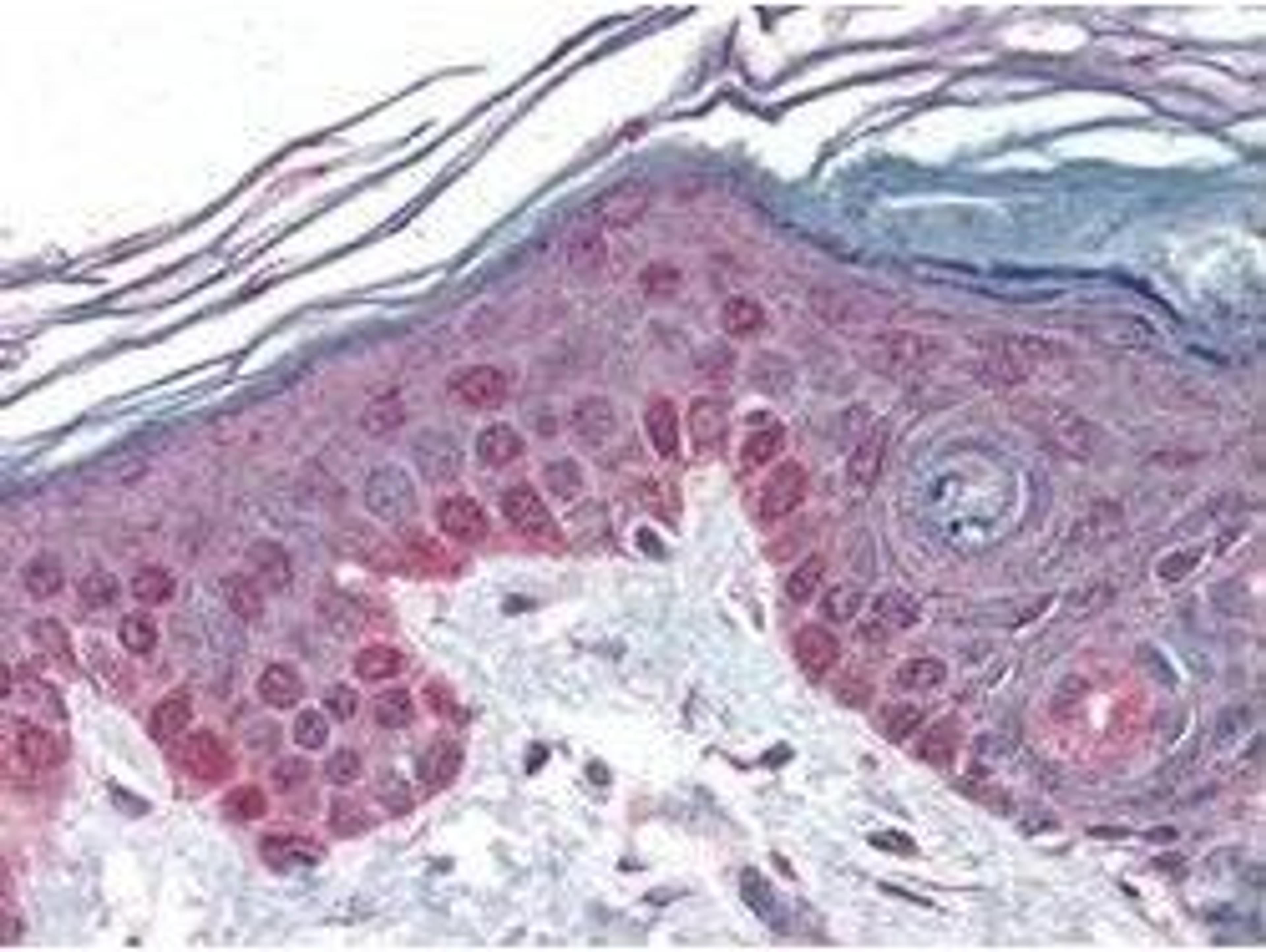 Immunohistochemical staining of human skin tissue using Cyclin T1 antibody