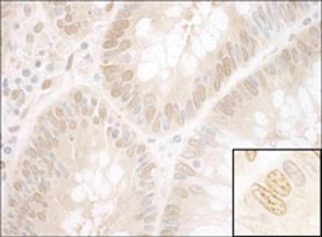 Detection of human NPAT by immunohistochemistry.