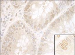 Detection of human NPAT by immunohistochemistry.