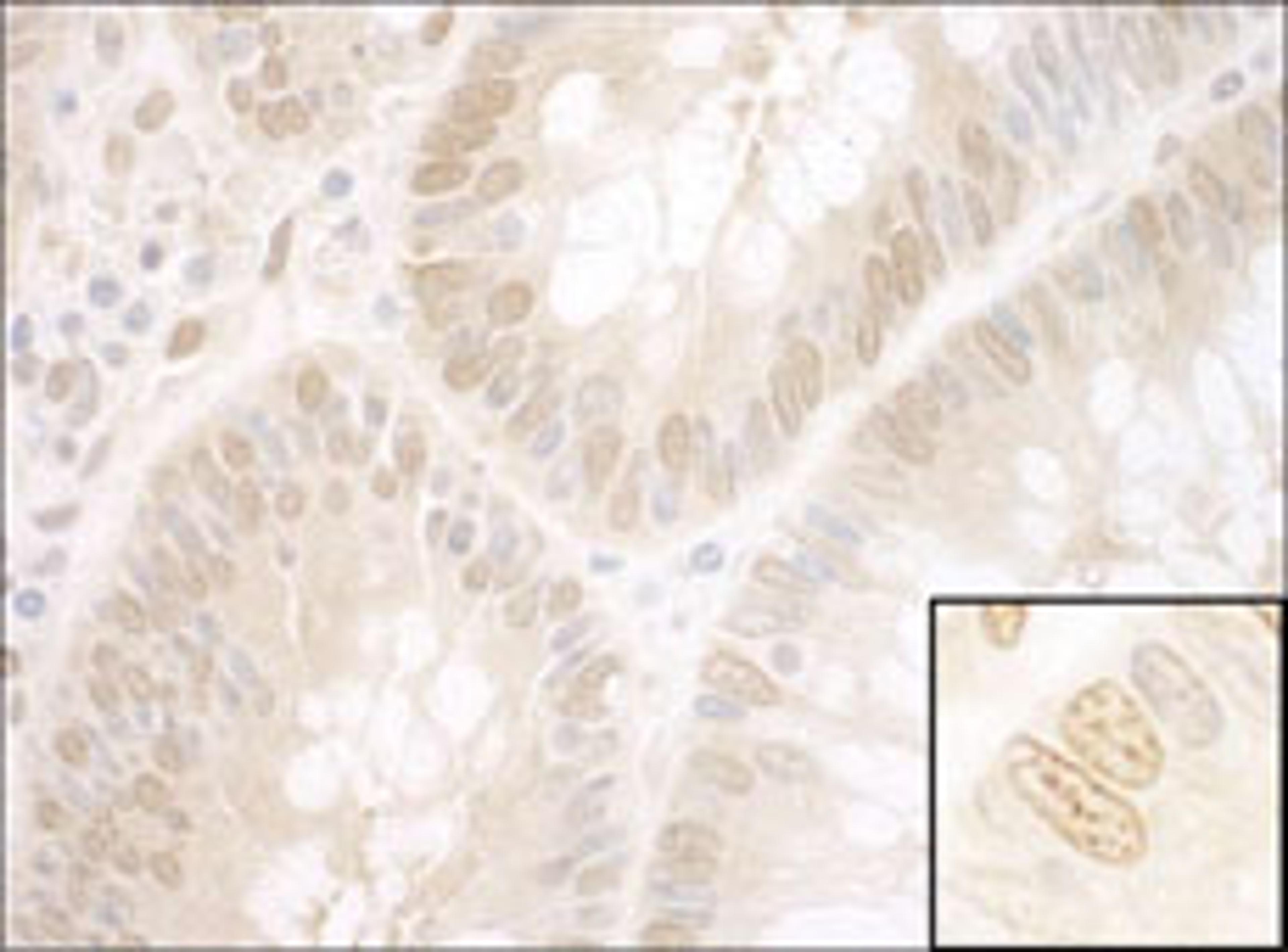 Detection of human NPAT by immunohistochemistry.