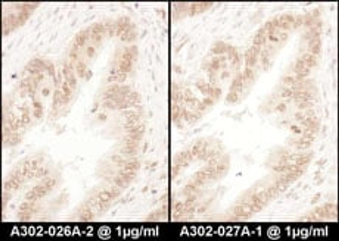 Detection of human RanGAP1 by immunohistochemistry.