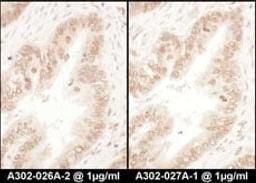 Detection of human RanGAP1 by immunohistochemistry.