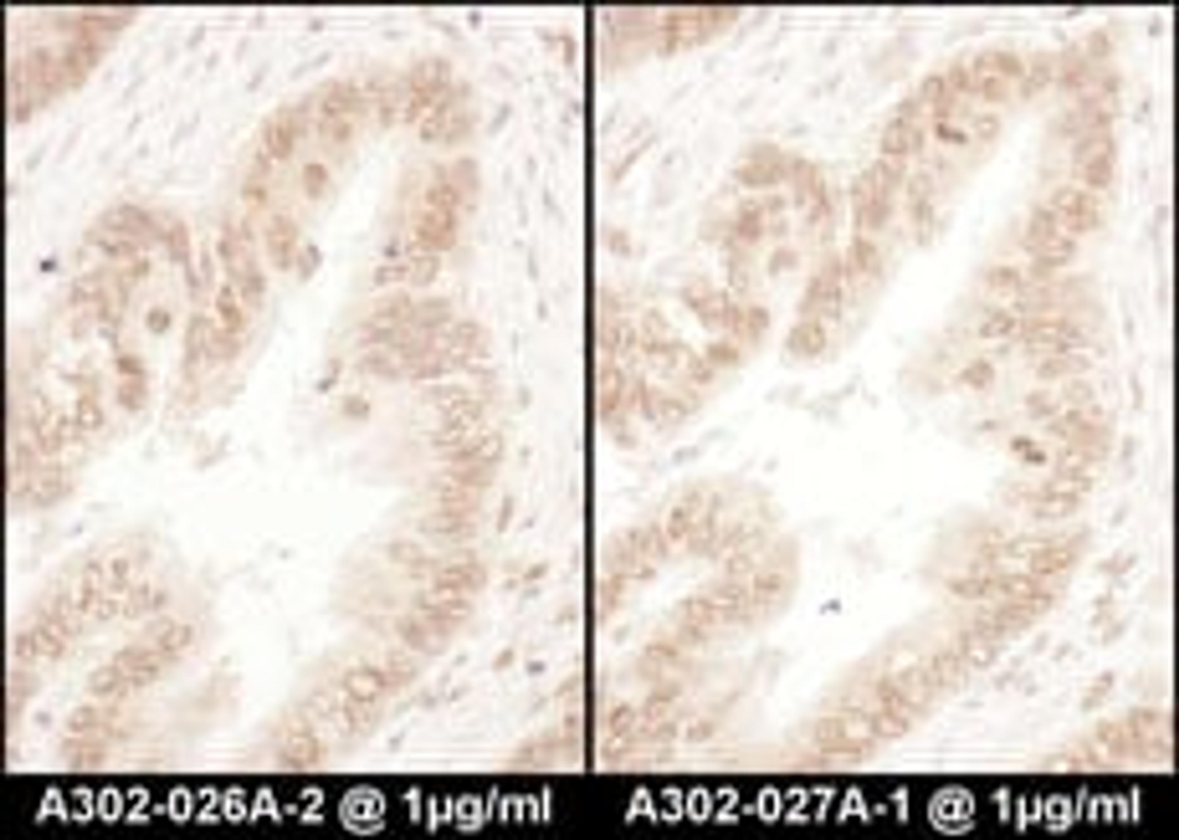 Detection of human RanGAP1 by immunohistochemistry.