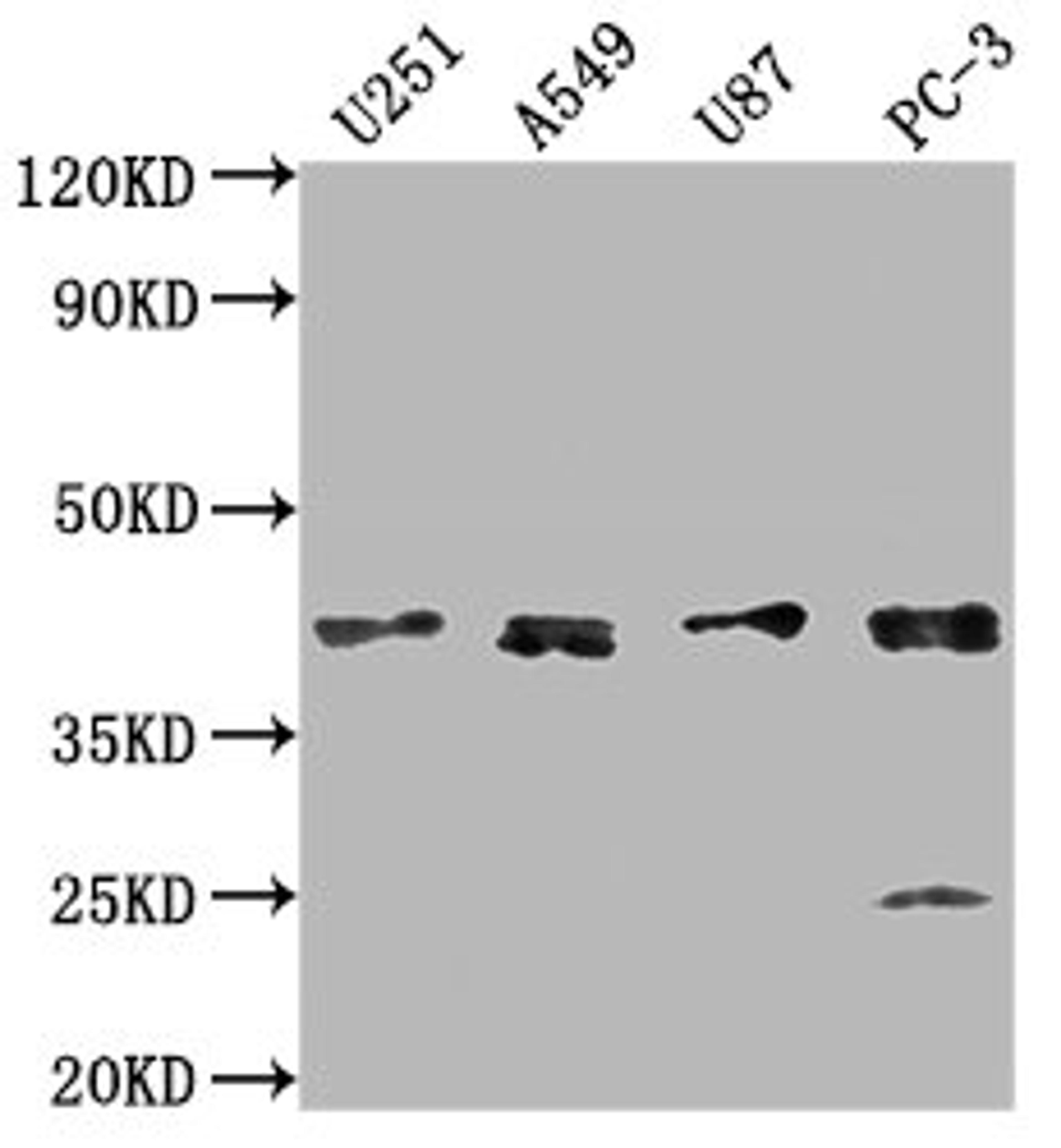 Western Blot. Positive WB detected in: U251 whole cell lysate, A549 whole cell lysate, U87 whole cell lysate, PC-3 whole cell lysate. All lanes: IKBIP antibody at 1:1000. Secondary. Goat polyclonal to rabbit IgG at 1/50000 dilution. Predicted band size: 40 kDa. Observed band size: 40 kDa. 