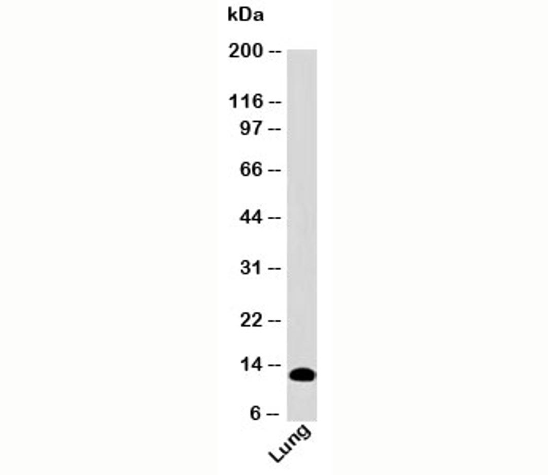 Western blot testing of human samples with S100A8 antibody SA6279 at 2ug/ml.