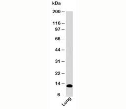 Western blot testing of human samples with S100A8 antibody SA6279 at 2ug/ml.