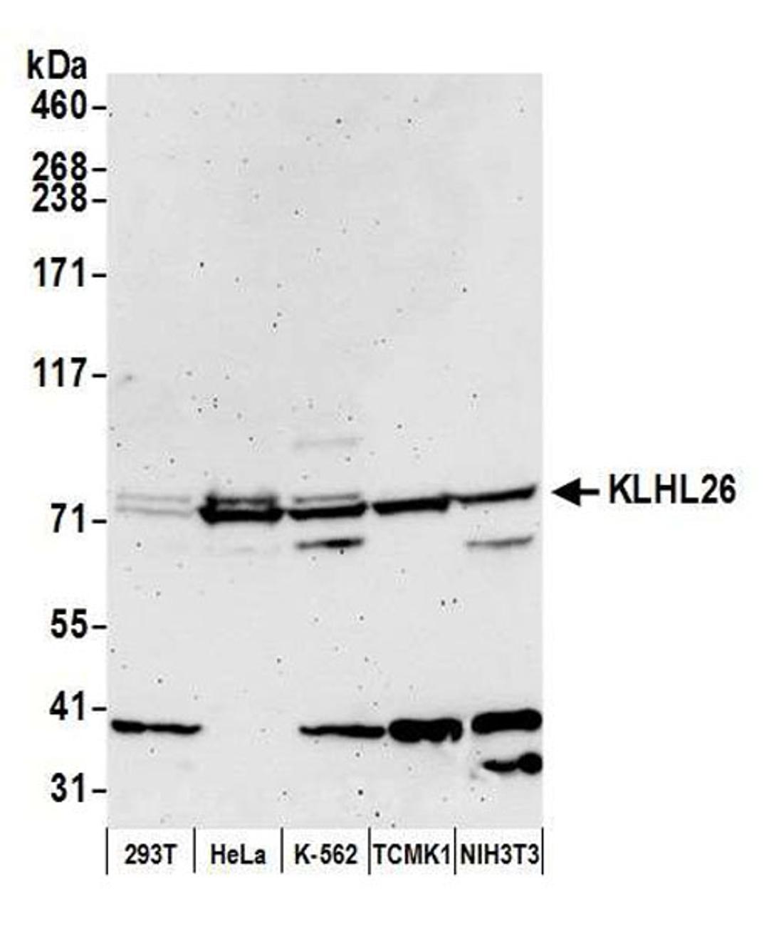 Detection of human and mouse KLHL26 by WB.