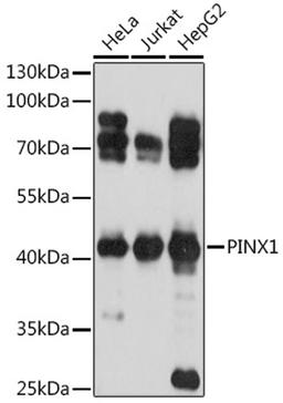 Western blot - PINX1 antibody (A17172)