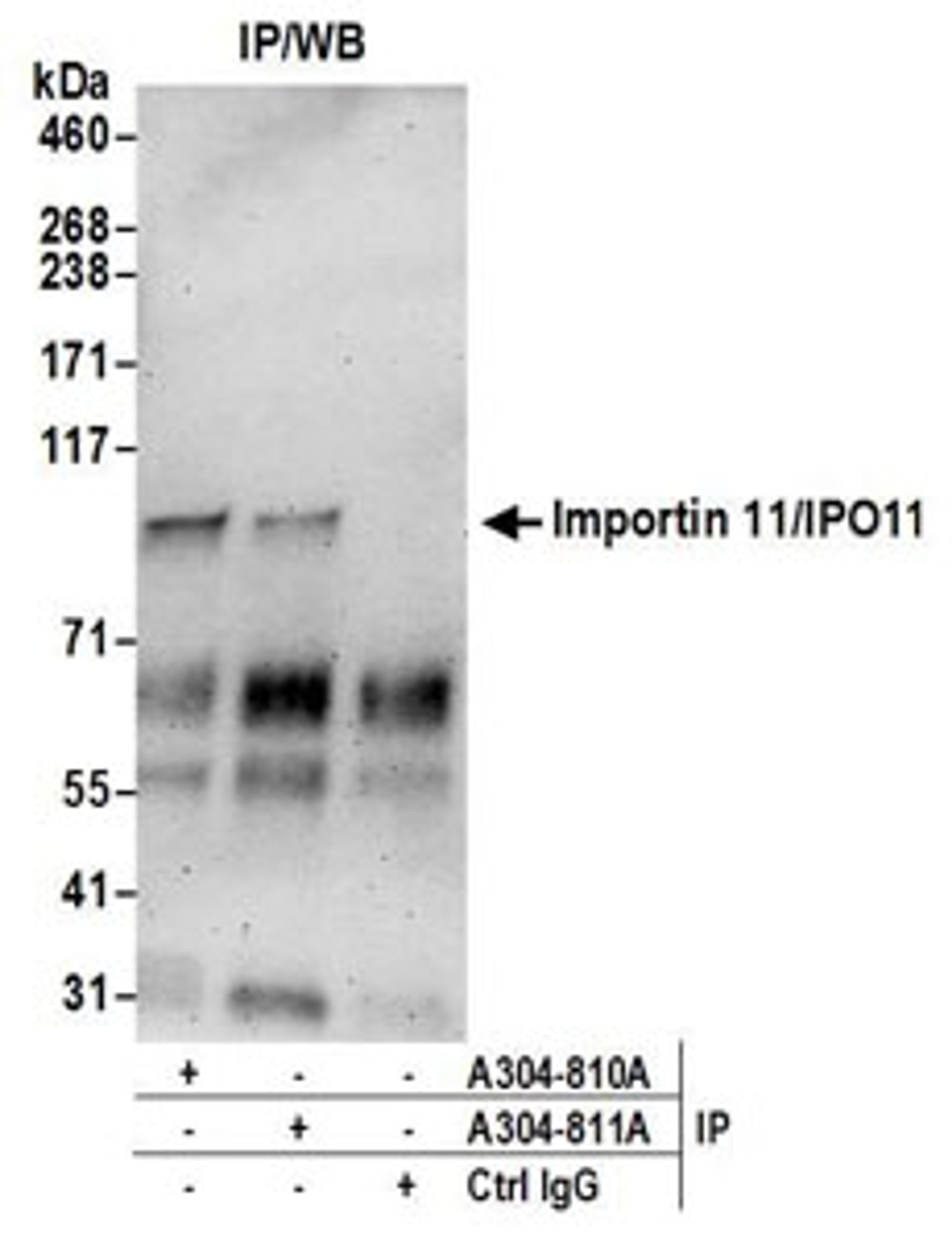 Detection of human Importin 11/IPO11 by western blot of immunoprecipitates.