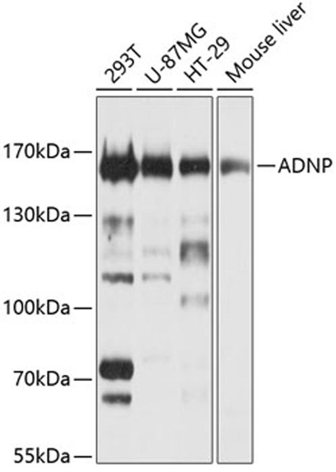 Western blot - ADNP Antibody (A4546)