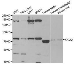 Western blot analysis of extracts of various cell lines using OCA2 antibody