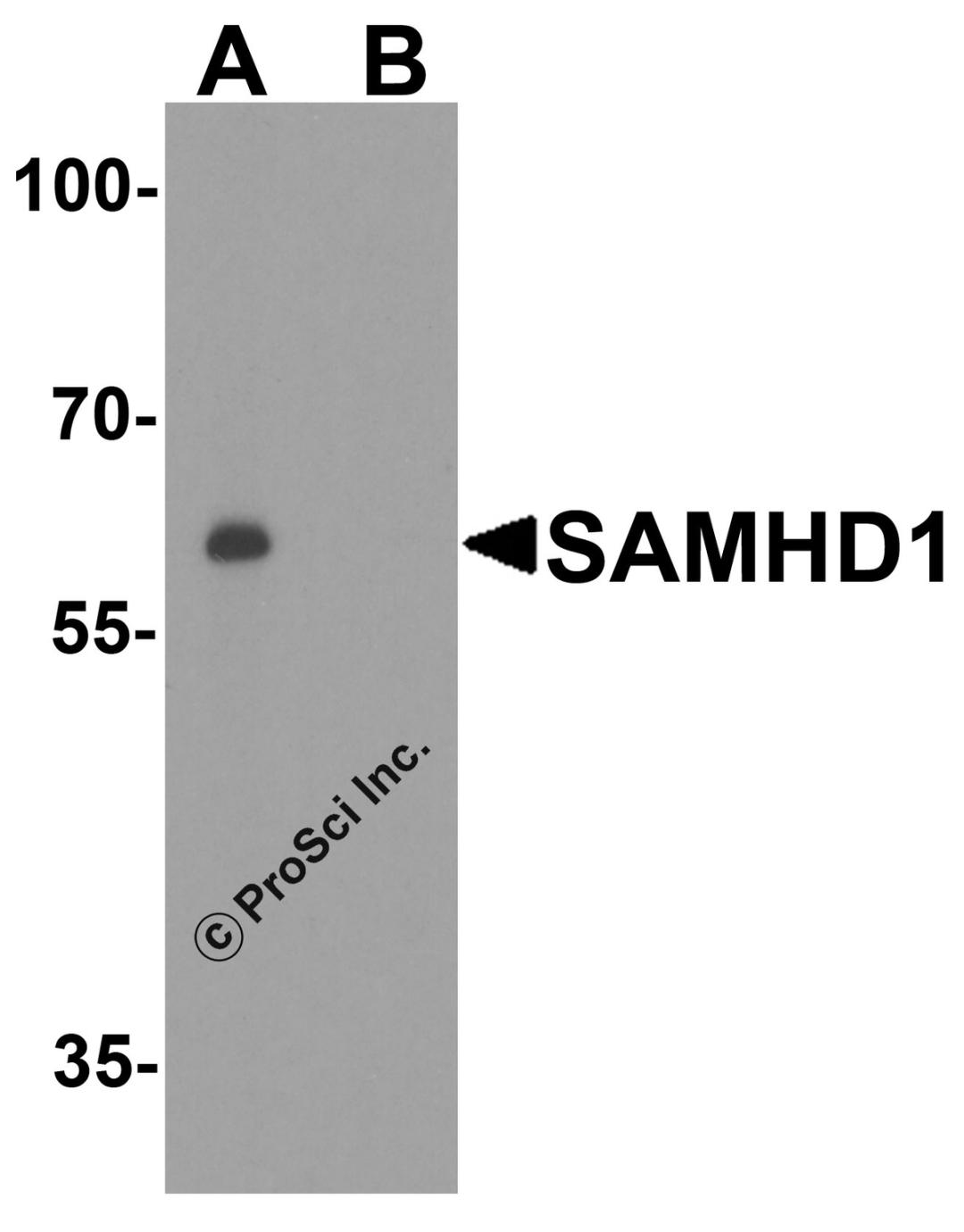 Western blot analysis of SAMHD1 in Daudi cell lysate with SAMHD1 antibody at 1 μg/ml in (A) the absence and (B) the presence of blocking peptide.